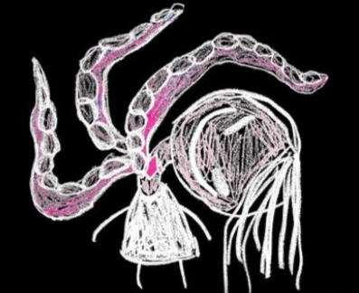 Группа Пошлая Молли выпустила новую песню "Акне"